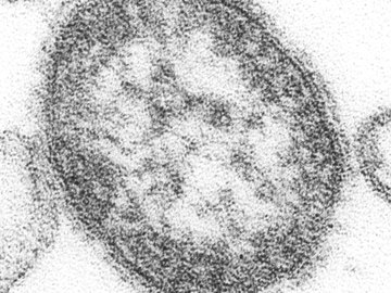 Original Title: 4424-measles-single particle