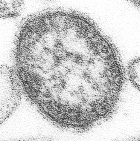 Original Title: 4424-measles-single particle